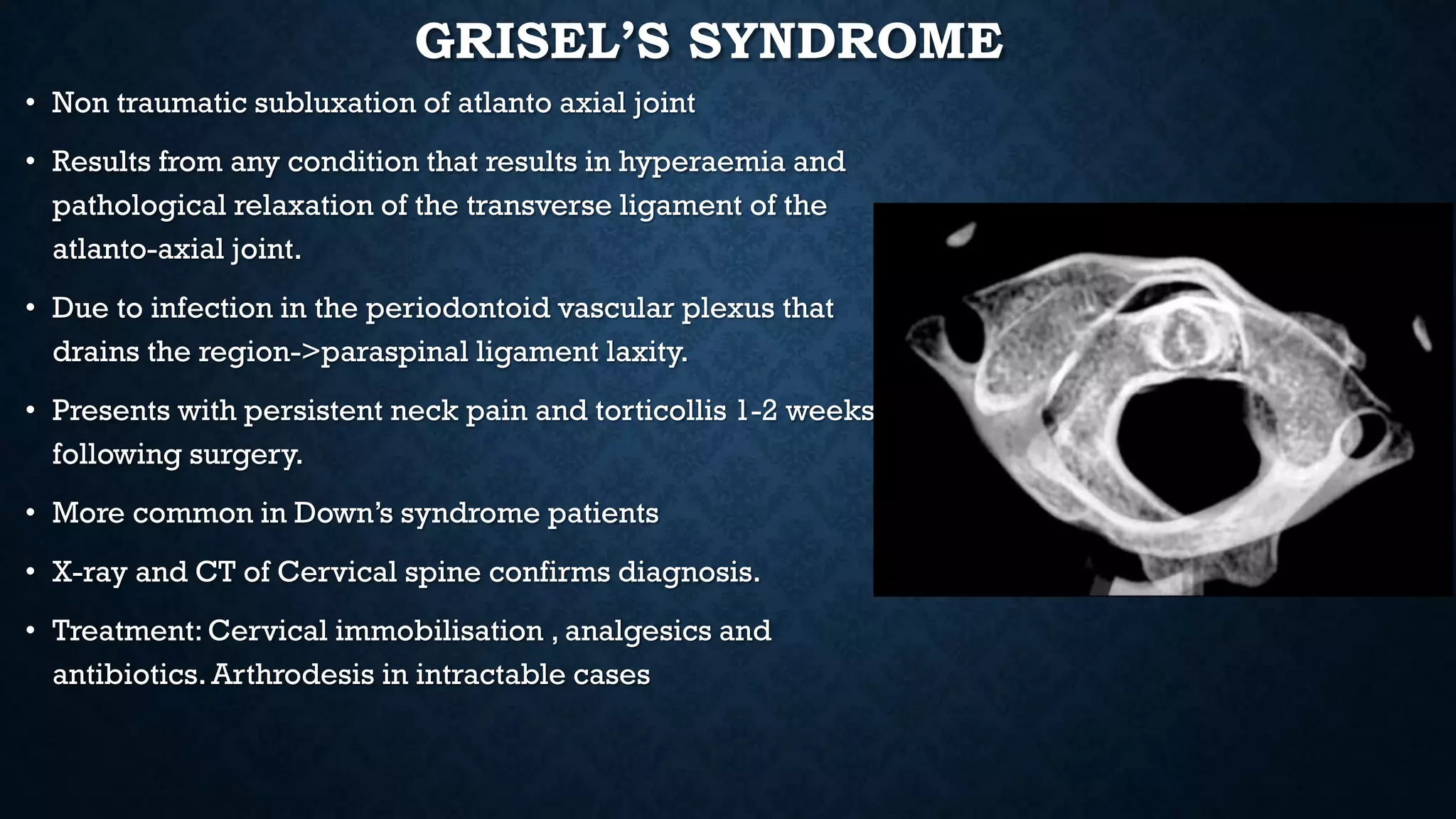 GRISEL’S SYNDROME
• Non traumatic subluxation of atlanto axial joint
• Results from any condition that results in hyperaemia and
pathological relaxation of the transverse ligament of the
atlanto-axial joint.
• Due to infection in the periodontoid vascular plexus that
drains the region->paraspinal ligament laxity.
• Presents with persistent neck pain and torticollis 1-2 weeks
following surgery.
• More common in Down’s syndrome patients
• X-ray and CT of Cervical spine confirms diagnosis.
• Treatment: Cervical immobilisation , analgesics and
antibiotics. Arthrodesis in intractable cases
 
