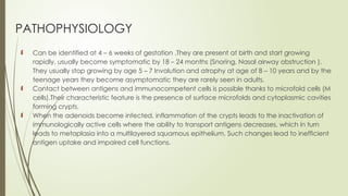 ADENOID HYPERPLASIA AND TONSILLITIS powerpoint | PPTX