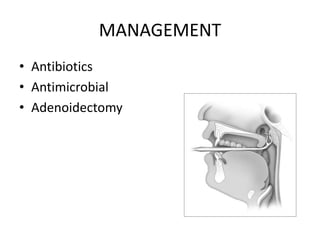 MANAGEMENT
• Antibiotics
• Antimicrobial
• Adenoidectomy
 