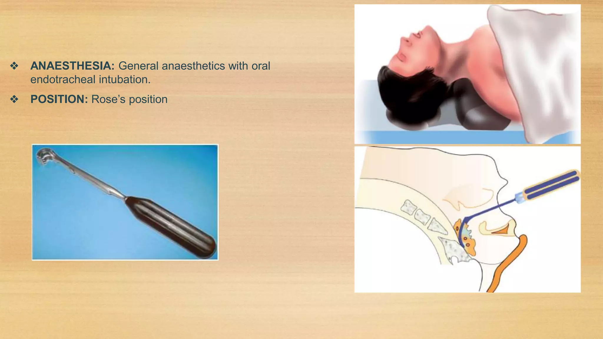 Adenoiditis & Adenoidectomy | PPTX