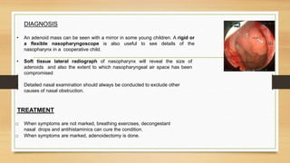 Adenoiditis & Adenoidectomy | PPT