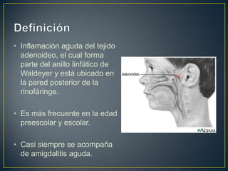 • Inflamación aguda del tejido
  adenoideo, el cual forma
  parte del anillo linfático de
  Waldeyer y está ubicado en
  la pared posterior de la
  rinofáringe.

• Es más frecuente en la edad
  preescolar y escolar.

• Casi siempre se acompaña
  de amigdalitis aguda.
 