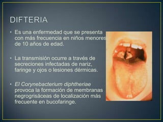 • Es una enfermedad que se presenta
  con más frecuencia en niños menores
  de 10 años de edad.

• La transmisión ocurre a través de
  secreciones infectadas de nariz,
  faringe y ojos o lesiones dérmicas.

• El Corynebacterium diphtheriae
  provoca la formación de membranas
  negrogrisáceas de localización más
  frecuente en bucofaringe.
 