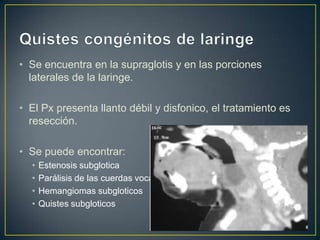• Se encuentra en la supraglotis y en las porciones
  laterales de la laringe.

• El Px presenta llanto débil y disfonico, el tratamiento es
  resección.

• Se puede encontrar:
  •   Estenosis subglotica
  •   Parálisis de las cuerdas vocales
  •   Hemangiomas subgloticos
  •   Quistes subgloticos
 