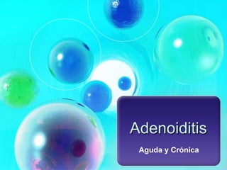 Adenoiditis
Aguda y Crónica

 