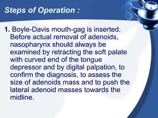 Steps of Operation :
1. Boyle-Davis mouth-gag is inserted.
Before actual removal of adenoids,
nasopharynx should always be
examined by retracting the soft palate
with curved end of the tongue
depressor and by digital palpation, to
confirm the diagnosis, to assess the
size of adenoids mass and to push the
lateral adenoid masses towards the
midline.
 