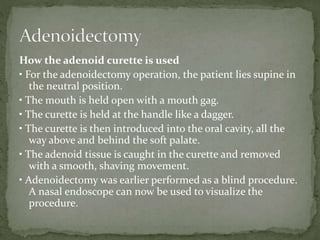 How the adenoid curette is used
• For the adenoidectomy operation, the patient lies supine in
the neutral position.
• The mouth is held open with a mouth gag.
• The curette is held at the handle like a dagger.
• The curette is then introduced into the oral cavity, all the
way above and behind the soft palate.
• The adenoid tissue is caught in the curette and removed
with a smooth, shaving movement.
• Adenoidectomy was earlier performed as a blind procedure.
A nasal endoscope can now be used to visualize the
procedure.
 