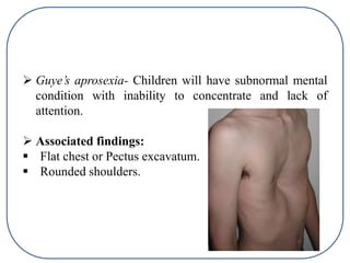  Guye’s aprosexia- Children will have subnormal mental
condition with inability to concentrate and lack of
attention.
 Associated findings:
 Flat chest or Pectus excavatum.
 Rounded shoulders.
 
