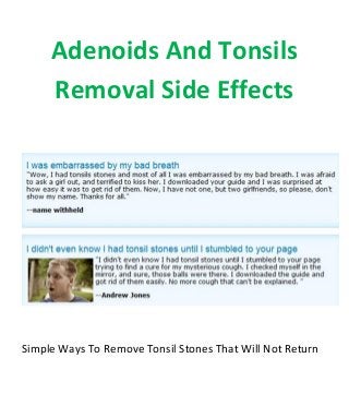 Adenoids And Tonsils
Removal Side Effects
Simple Ways To Remove Tonsil Stones That Will Not Return
 