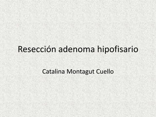 Resección adenoma hipofisario

     Catalina Montagut Cuello
 