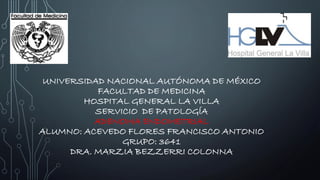 UNIVERSIDAD NACIONAL AUTÓNOMA DE MÉXICO
FACULTAD DE MEDICINA
HOSPITAL GENERAL LA VILLA
SERVICIO DE PATOLOGÍA
ADENOMA ENDOMETRIAL
ALUMNO: ACEVEDO FLORES FRANCISCO ANTONIO
GRUPO: 3641
DRA. MARZIA BEZZERRI COLONNA
 