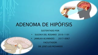ADENOMA DE HIPÓFISIS
SUSTENTADO POR:
• SULEIKA DEL ROSARIO 2016-1191
• JAMILKA ALVARADO 2017-0067
FACILITADOR:
DR. JOSÉ LUIS PICHARDO
 