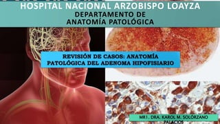 HOSPITAL NACIONAL ARZOBISPO LOAYZA
DEPARTAMENTO DE
ANATOMÍA PATOLÓGICA
MR1. DRA. KAROL M. SOLÓRZANO
PALACIOS
 