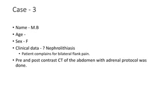 Case - 3
• Name - M.B
• Age -
• Sex - F
• Clinical data - ? Nephrolithiasis
• Patient complains for bilateral flank pain.
• Pre and post contrast CT of the abdomen with adrenal protocol was
done.
 