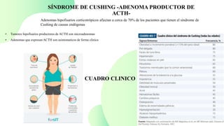 CUADRO CLINICO
SÍNDROME DE CUSHING -ADENOMA PRODUCTOR DE
ACTH-
Adenomas hipofisarios corticotrópicos af|ectan a cerca de 70% de los pacientes que tienen el síndrome de
Cushing de causas endógenas
• Tumores hipofisarios productores de ACTH son microadenomas
• Adenomas que expresan ACTH son asintomaticos de forma clinica
 