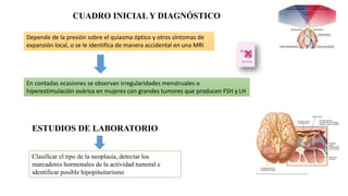 CUADRO INICIAL Y DIAGNÓSTICO
Depende de la presión sobre el quiasma óptico y otros síntomas de
expansión local, o se le identifica de manera accidental en una MRI
En contadas ocasiones se observan irregularidades menstruales o
hiperestimulación ovárica en mujeres con grandes tumores que producen FSH y LH
ESTUDIOS DE LABORATORIO
Clasificar el tipo de la neoplasia, detectar los
marcadores hormonales de la actividad tumoral e
identificar posible hipopituitarismo
 