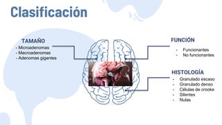 Clasificación
- Microadenomas
- Macroadenomas
- Adenomas gigantes
TAMAÑO FUNCIÓN
- Granulado escaso
- Granulado denso
- Células de crooke
- Silentes
- Nulas
HISTOLOGÍA
- Funcionantes
- No funcionantes
 