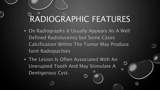 Aot Radiograph Adenomatoid odontogenic tumor | PPTX