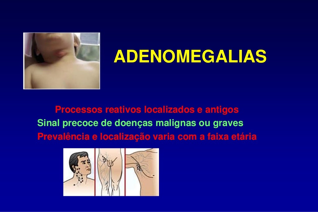 O Que é Adenomegalias - BRAINCP