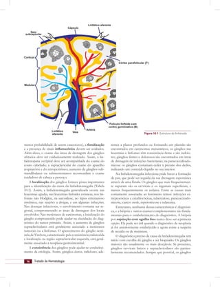 76 Tratado de Hematologia
menos probabilidade de serem cancerosos), a ﬁstulização
e a presença de sinais inﬂamatórios devem ser avaliados.
Além disso, o exame das áreas de drenagem dos gânglios
afetados deve ser cuidadosamente realizado. Assim, a lin-
fadenopatia occipital deve ser acompanhada do exame do
couro cabeludo; a supraclavicular do exame do aparelho
respiratório e do retroperitôneo; aumento de gânglios sub-
mandibulares ou submentonianos recomendam o exame
cuidadoso de cabeça e pescoço.
A localização dos gânglios fornece pistas importantes
para a identiﬁcação da causa da linfadenomegalia (Tabela
10.1). Assim, a linfadenomegalia generalizada ocorre nas
leucemias agudas, nas leucemias linfoides crônicas, nos lin-
fomas não Hodgkin, na sarcoidose, no lúpus eritematoso
sistêmico, nas reações a drogas, e em algumas infecções.
Nas doenças infecciosas, o envolvimento costuma ser re-
gional, comprometendo as áreas de drenagem dos locais
envolvidos. Nas metástases de carcinomas, a localização do
gânglio comprometido pode ajudar na elucidação do diag-
nóstico do tumor primário. Assim, o aumento de gânglios
supraclaviculares está geralmente associado a metástases
tumorais ou a linfomas. O aparecimento do gânglio senti-
nela de Virchow, caracterizado pela consistência endurecida
e localização na região supraclavicular esquerda, está geral-
mente associado a neoplasia gastrointestinal.
A consistência dos gânglios pode ajudar no estabeleci-
mento da etiologia. Assim, gânglios duros, indolores, ade-
Figura 10.1 Estrutura do linfonodo.
rentes a planos profundos ou formando um plastrão são
encontrados em carcinomas metastáticos; os gânglios nas
leucemias e linfomas têm consistência ﬁrme e são indolo-
res; gânglios ﬁrmes e dolorosos são encontrados em áreas
de drenagem de infecções bacterianas; na paracoccidioido-
micose os gânglios costumam ceder à pressão dos dedos,
indicando um conteúdo líquido no seu interior.
Na linfadenomegalia infecciosa pode haver a formação
de pus, que pode ser seguida da sua drenagem espontânea
através de uma fístula. Os gânglios que mais frequentemen-
te supuram são os cervicais e os inguinais superﬁciais, e
menos frequentemente os axilares. Entre as causas mais
comumente associadas ao fenômeno temos: infecções es-
treptocócicas e estaﬁlocócicas, tuberculose, paracoccioido-
micose, cancro mole, esporotricose e tularemia.
Entretanto, nenhuma dessas características é diagnósti-
ca, e a biópsia e outros exames complementares são funda-
mentais para o estabelecimento do diagnóstico. A biópsia
por aspiração com agulha ﬁna nunca deve ser a primeira
opção. Ela pode ser útil quando o diagnóstico de neoplasia
já foi anteriormente estabelecido e agora existe a suspeita
de recaída ou de metástase.
O diagnóstico preciso da causa da linfadenomegalia tem
início com escolha do gânglio a ser biopsiado. Os gânglios
maiores são usualmente os mais desejáveis. Se presentes,
gânglios cervicais baixos e supraclaviculares são particu-
larmente recomendados. Sempre que possível, os gânglios
 
