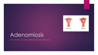 Adenomiosis
DR. ME RIO MANUEL HERNÁNDEZ RODRÍGUEZ
 