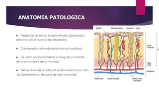 ANATOMIA PATOLOGICA
 Presencia de islotes endometriales (glándulas y
estroma) en el espesor del miometrio.
 Crecimiento del endometrio en profundidad
 La unión endomiometrial es irregular y carente
de una muscular de la mucosa
 Generalmente se trata de endometrio basal, sólo
ocasionalmente, de zona de tipo funcional
 