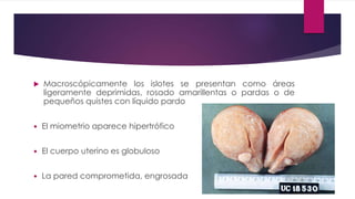  Macroscópicamente los islotes se presentan como áreas
ligeramente deprimidas, rosado amarillentas o pardas o de
pequeños quistes con líquido pardo
 El miometrio aparece hipertrófico
 El cuerpo uterino es globuloso
 La pared comprometida, engrosada
 