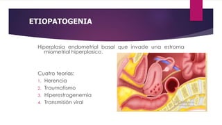 ETIOPATOGENIA
Hiperplasia endometrial basal que invade una estroma
miometrial hiperplasico.
Cuatro teorías:
1. Herencia
2. Traumatismo
3. Hiperestrogenemia
4. Transmisión viral
 