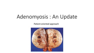 Adenomyosis : An Update
Patient oriented approach
 