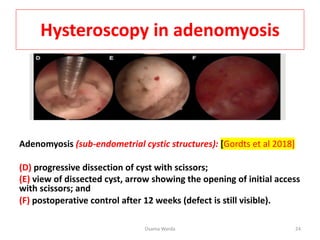 ADENOMYOSIS AND INFERTILITY UPDATE PDF