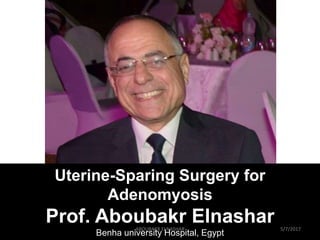 Uterine-Sparing Surgery for
Adenomyosis
Prof. Aboubakr Elnashar
Benha university Hospital, Egypt
5/7/2017ABOUBAKR ELNASHAR
 