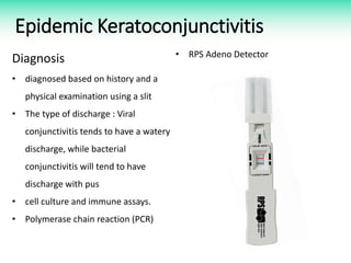 Epidemic Keratoconjunctivitis
Diagnosis
• diagnosed based on history and a
physical examination using a slit
• The type of discharge : Viral
conjunctivitis tends to have a watery
discharge, while bacterial
conjunctivitis will tend to have
discharge with pus
• cell culture and immune assays.
• Polymerase chain reaction (PCR)
• RPS Adeno Detector
 