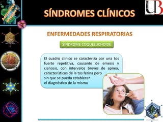 SÍNDROME COQUELUCHOIDE
El cuadro clínico se caracteriza por una tos
fuerte repetitiva, causante de emesis y
cianosis, con intervalos breves de apnea,
característicos de la tos ferina pero
sin que se pueda establecer
el diagnóstico de la misma
 