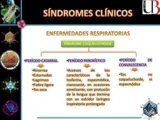 SÍNDROME COQUELUCHOIDE
•PERÍODO CATARRAL
•Rinorrea
•Estornudos
•Lagrimeo
•Fiebre ligera
•Tos seca
•PERÍODO PAROXÍSTICO
•Accesos de tos
característicos de la
tosferina, espasmódica,
cianosante, en ocasiones
emetizante, con protusión
de la lengua que termina
con un estridor laríngeo
inspiratorio prolongado
•PERÍODO DE
CONVALECENCIA
•Tos no
coqueluchoide, ni
espasmódica
 