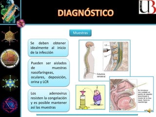 Muestras
Se deben obtener
idealmente al inicio
de la infección
Los adenovirus
resisten la congelación
y es posible mantener
así las muestras
Pueden ser aislados
de muestras
nasofaríngeas,
oculares, deposición,
orina y LCR
 