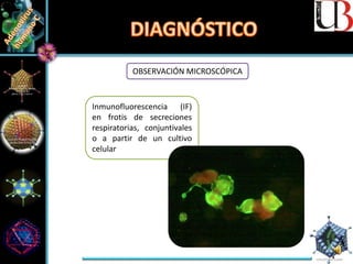 OBSERVACIÓN MICROSCÓPICA
Inmunofluorescencia (IF)
en frotis de secreciones
respiratorias, conjuntivales
o a partir de un cultivo
celular
 