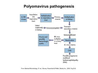 From Medical Microbiology, 5th
ed., Murray, Rosenthal & Pfaller, Mosby Inc., 2005, Fig.52-8.
Polyomavirus pathogenesis
 