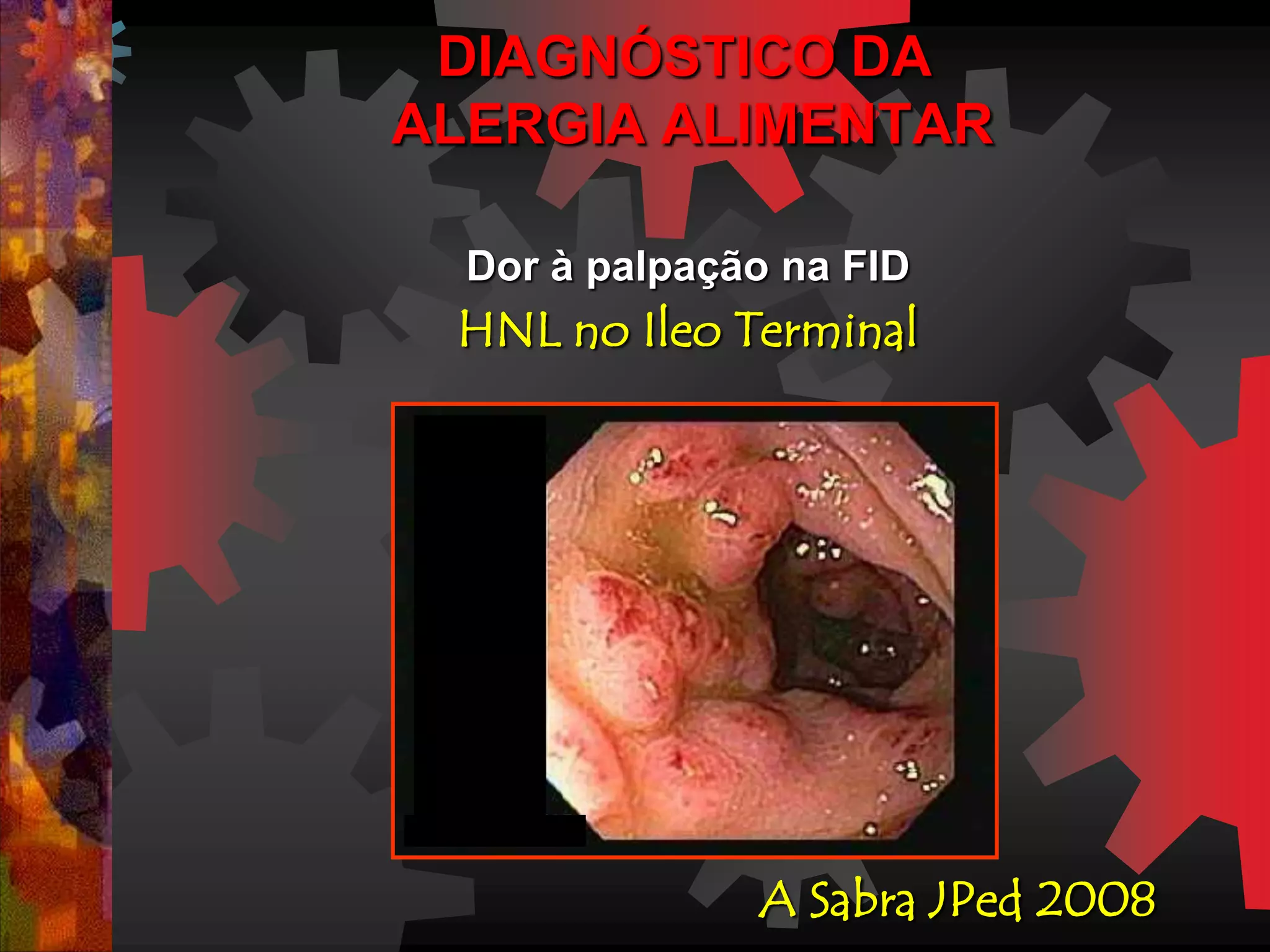 DIAGNÓSTICO DA
ALERGIA ALIMENTAR
Dor à palpação na FID
HNL no Ileo Terminal
A Sabra JPed 2008
 