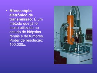 • Microscópio
eletrônico de
transmissão: É um
método que já foi
muito utilizado no
estudo de biópsias
renais e de tumores.
Poder de resolução:
100.000x.
 