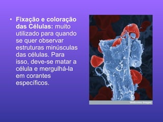 • Fixação e coloração
das Células: muito
utilizado para quando
se quer observar
estruturas minúsculas
das células. Para
isso, deve-se matar a
célula e mergulhá-la
em corantes
específicos.
 