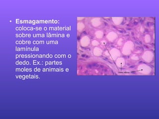 • Esmagamento:
coloca-se o material
sobre uma lâmina e
cobre com uma
lamínula
pressionando com o
dedo. Ex.: partes
moles de animais e
vegetais.
 