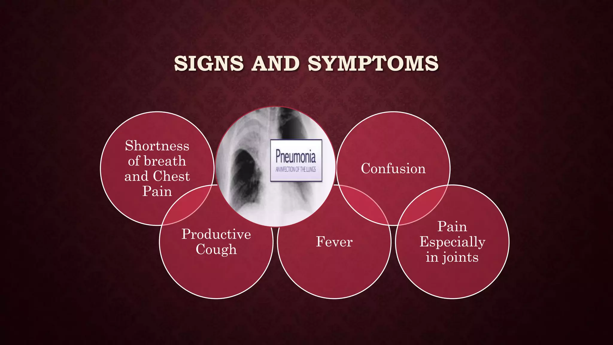 a-descriptive-review-of-pneumonia-ppt