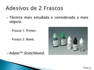 Adesivos odontológicos e fatores de contração 2012 1 Slide 40