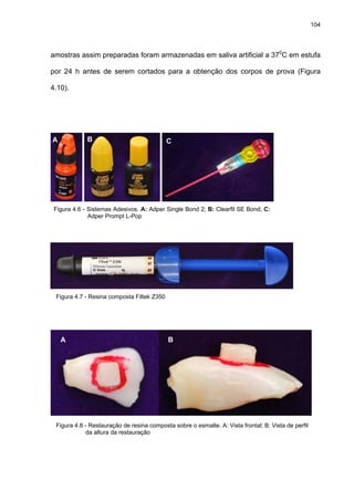 104




amostras assim preparadas foram armazenadas em saliva artificial a 370C em estufa

por 24 h antes de serem cortados para a obtenção dos corpos de prova (Figura

4.10).




A            B                              C




 Figura 4.6 - Sistemas Adesivos. A: Adper Single Bond 2; B: Clearfil SE Bond; C:
              Adper Prompt L-Pop




 Figura 4.7 - Resina composta Filtek Z350




    A                                       B




 Figura 4.8 - Restauração de resina composta sobre o esmalte. A: Vista frontal; B: Vista de perfil
             da altura da restauração
 