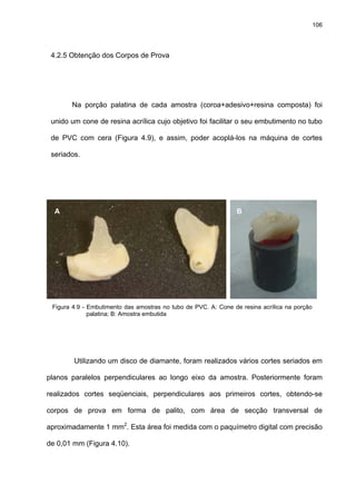 106




 4.2.5 Obtenção dos Corpos de Prova




       Na porção palatina de cada amostra (coroa+adesivo+resina composta) foi

 unido um cone de resina acrílica cujo objetivo foi facilitar o seu embutimento no tubo

 de PVC com cera (Figura 4.9), e assim, poder acoplá-los na máquina de cortes

 seriados.




  A                                                             B




 Figura 4.9 - Embutimento das amostras no tubo de PVC. A: Cone de resina acrílica na porção
              palatina; B: Amostra embutida




        Utilizando um disco de diamante, foram realizados vários cortes seriados em

planos paralelos perpendiculares ao longo eixo da amostra. Posteriormente foram

realizados cortes seqüenciais, perpendiculares aos primeiros cortes, obtendo-se

corpos de prova em forma de palito, com área de secção transversal de

aproximadamente 1 mm2. Esta área foi medida com o paquímetro digital com precisão

de 0,01 mm (Figura 4.10).
 