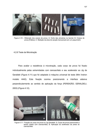 107




                                  A                          B                                  C

 Figura 4.10 - Obtenção dos corpos de prova. A: Corte das amostras na Isomet; B: Corpos de
               prova (Palitos); C: Medição da área de secção transversal com um paquímetro




 4.2.6 Teste de Microtração




       Para avaliar a resistência à microtração, cada corpo de prova foi fixado

individualmente pelas extremidades com cianoacrilato e seu acelerador ao Jig de

Geraldeli (Figura 4.11) que foi adaptado à máquina universal de teste (Mini Instron

modelo     4442).     Esta    fixação     ocorreu     posicionando       a    interface       adesiva

perpendicularmente ao sentido de aplicação da força (PERDIGÃO; GERALDELI,

2003) (Figura 4.12).




                                         A                                           B
  Figura 4.11 - Fixação do corpo de prova no Jig Geraldeli. A: Corpo de prova posicionado e
               sendo colado com cianoacrilato; B: Aplicação do acelerador de presa do
               cianoacrilato
 