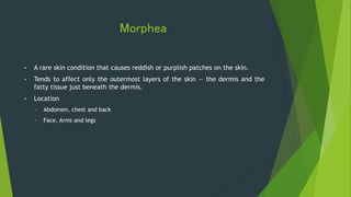 Morphea
 A rare skin condition that causes reddish or purplish patches on the skin.
 Tends to affect only the outermost layers of the skin — the dermis and the
fatty tissue just beneath the dermis.
 Location
 Abdomen, chest and back
 Face, Arms and legs
 