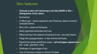 Skin features
 Clinically evident skin thickening is the HALLMARK of SSc—
distinguishes it from others..
 Symmetrical
 In diffuse type – edema replaced by skin thickening..distal to proximal –
centripetal fashion.
 Skin is firm ,coarse and thickened.
 Darkly pigmented extremities and trunk.
 Diffuse tanning in the absence of exposure to sun –very early feature.
 Vitiligo like hypopigmentation –in dark skinned individuals.
 Pigment loss spares perifollicluar areas – salt and pepper appearance of
skin –scalp ,upperback ,chest.
 Obliteration of appendages of hair.
 Loss of transverse creases on dorsum of fingers
 