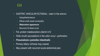 Git
 GASTRIC VASCULAR ECTASIAs – seen in the antrum.
• Subepithelial lesions
• Diffuse small vessel vsculopathy
• Watermelon appearance
• Recurrent GI bleed occult
 Fat ,protein malabsorption,vitamin b12
 Wide mouth sacculations in the colon occur –perforation.
 Pneumatosis cystoides intestinalis
 Primary biliary cirrhosis may coexist.
 May present with recurrent acute abdominal pain.
 