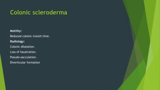 Colonic scleroderma
Motility:
Reduced colonic transit time.
Radiology:
Colonic dilatation.
Loss of haustration.
Pseudo-sacculation.
Diverticular formation.
 